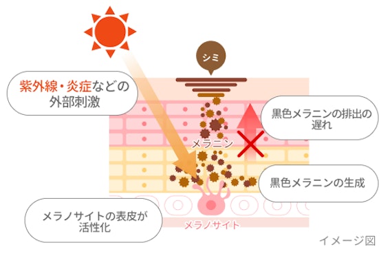 シミの原因・仕組み